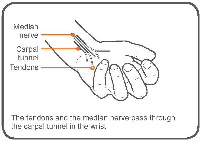 Carpal Tunnel Syndrome Stretches