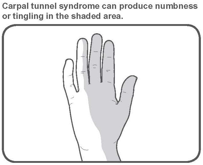 How to Sleep with Carpal Tunnel Syndrome: Positions and More